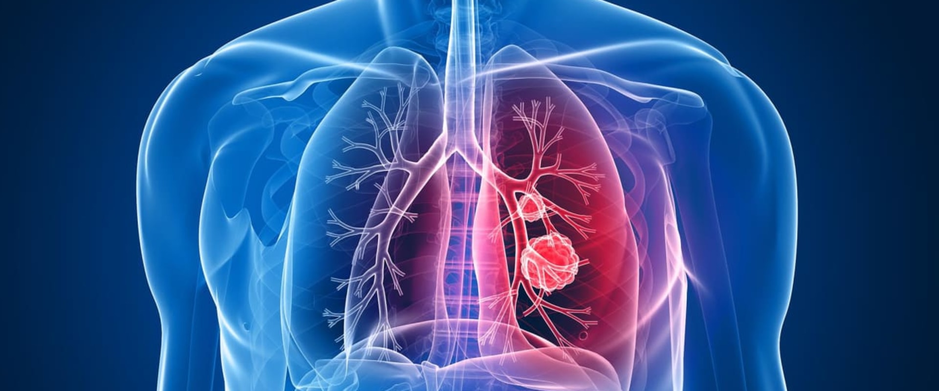 Where are the lung institutes?