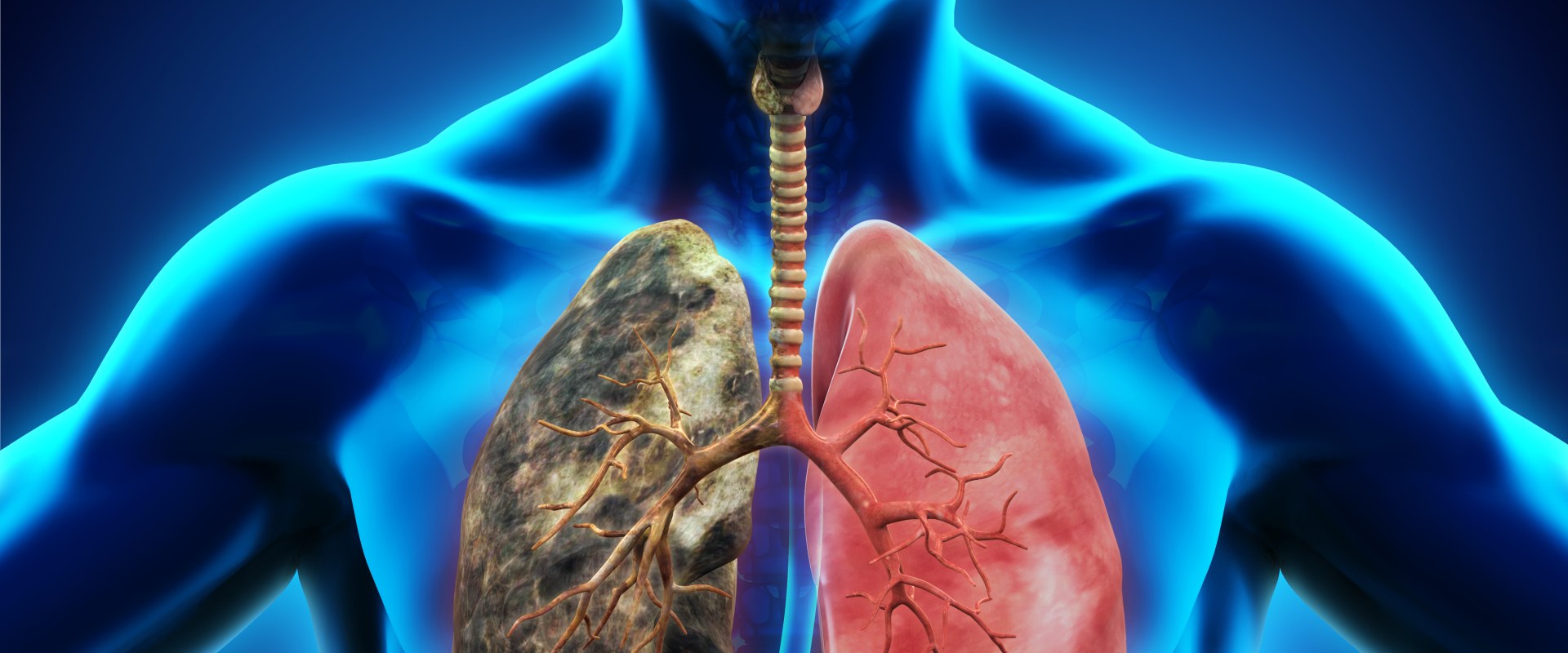 What are Common Forms of Lung Disease?
