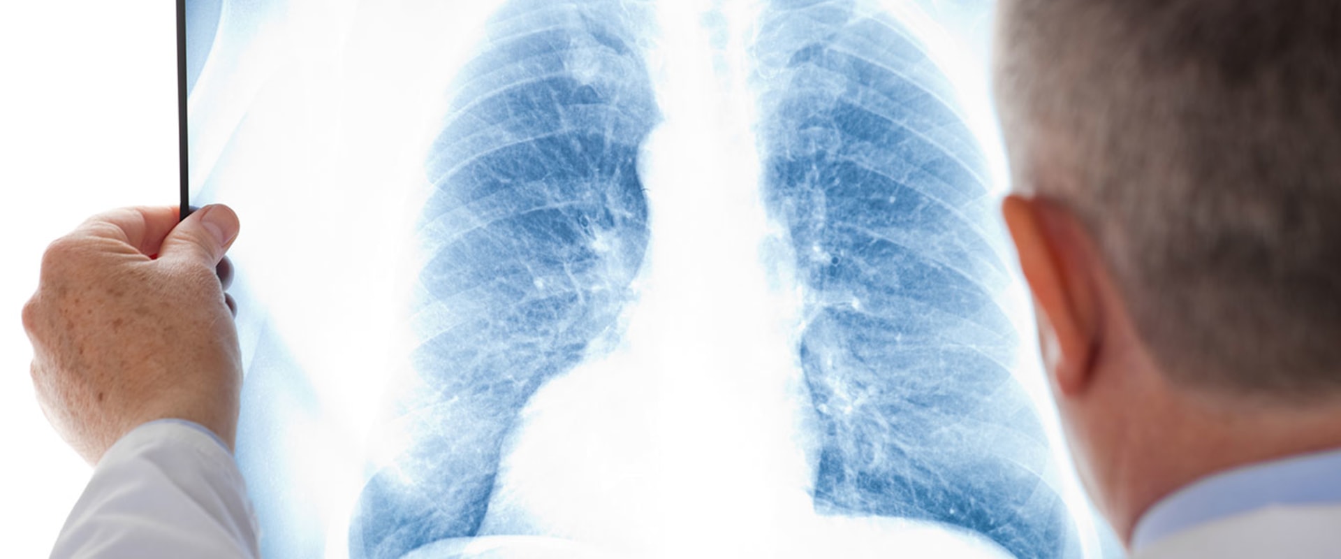 Can lungs heal after 20 years of smoking?