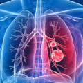 Where are the lung institutes?