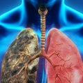 What are Common Forms of Lung Disease?