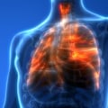 What is lung health?