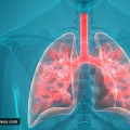 What is Lung Health & Why is it Important?