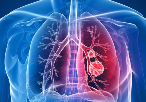 Where are the lung institutes?