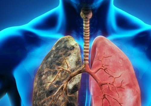 What are Common Forms of Lung Disease?