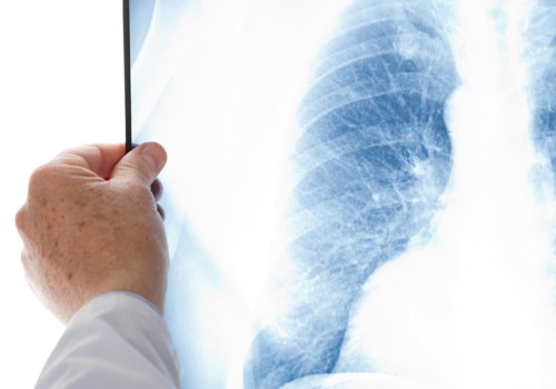 Can lungs heal after 20 years of smoking?